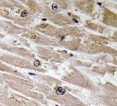 BMP2 Antibody (aa250-350)