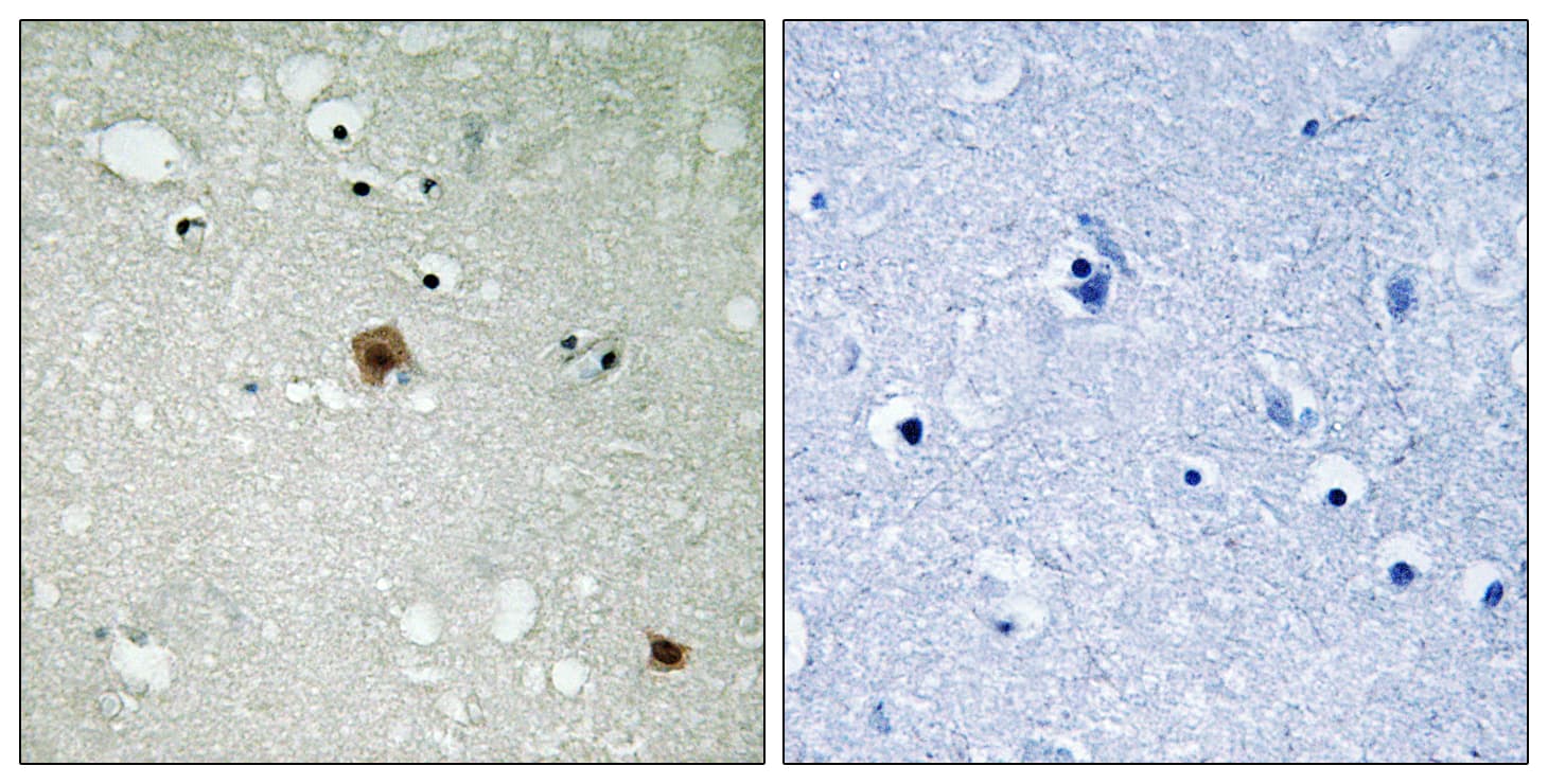 TOP2A / Topoisomerase II Alpha Antibody (phospho-Ser1525)