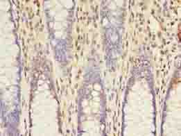 ACS5 / ACSL5 Antibody