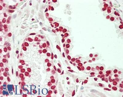 IHC-plus™ HOXD10 Antibody (aa201-230)