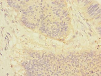 DSC1 / Desmocollin 1 Antibody