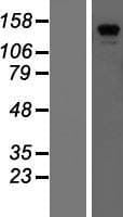 CDAN1 Protein (Over-Expression Lysate Myc-DDK (Flag))