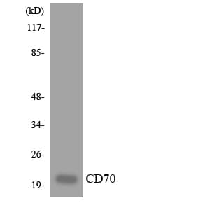CD27L / CD70 Antibody (aa52-101)