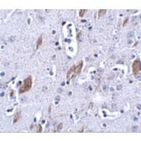 Polyclonal Rabbit anti-Human ATOH8 Antibody (IHC, WB)