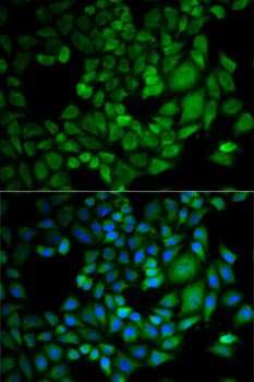 Polyclonal Rabbit anti-Human DDX / AKR1C3 Antibody (IHC, IF, WB)