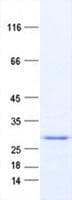 Human TK2 Protein (Recombinant His, N-Terminal)