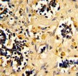 NDUFS4 Antibody (aa131-160)