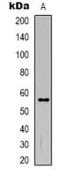 Polyclonal Rabbit anti-Human TMEM145 Antibody (Internal, WB)