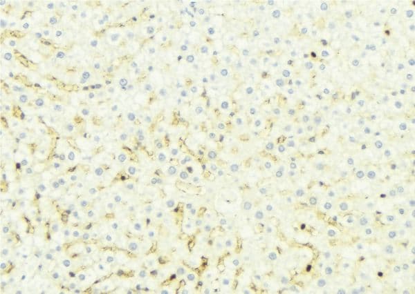 SLC27A5 / BACS Antibody