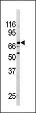 Polyclonal Rabbit anti-Human NR4A2 / NURR1 Antibody (aa13-42, IHC, IF, WB)