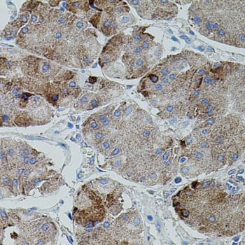 APP / Beta Amyloid Precursor Antibody