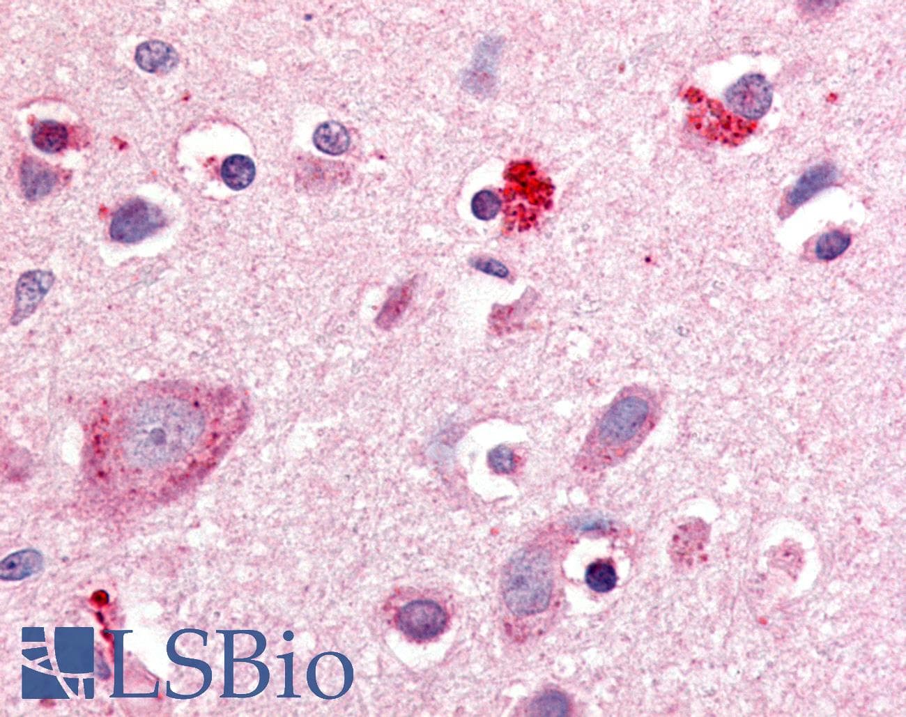 IHC-plus™ RORB / ROR Beta Antibody (Hinge Domain)
