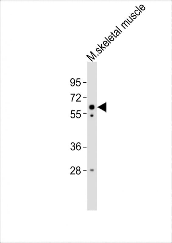 Polyclonal Rabbit anti-Mouse BAF60C / SMARCD3 Antibody (aa158-193, WB)