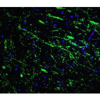 IHC-plus™ PINK1 Antibody