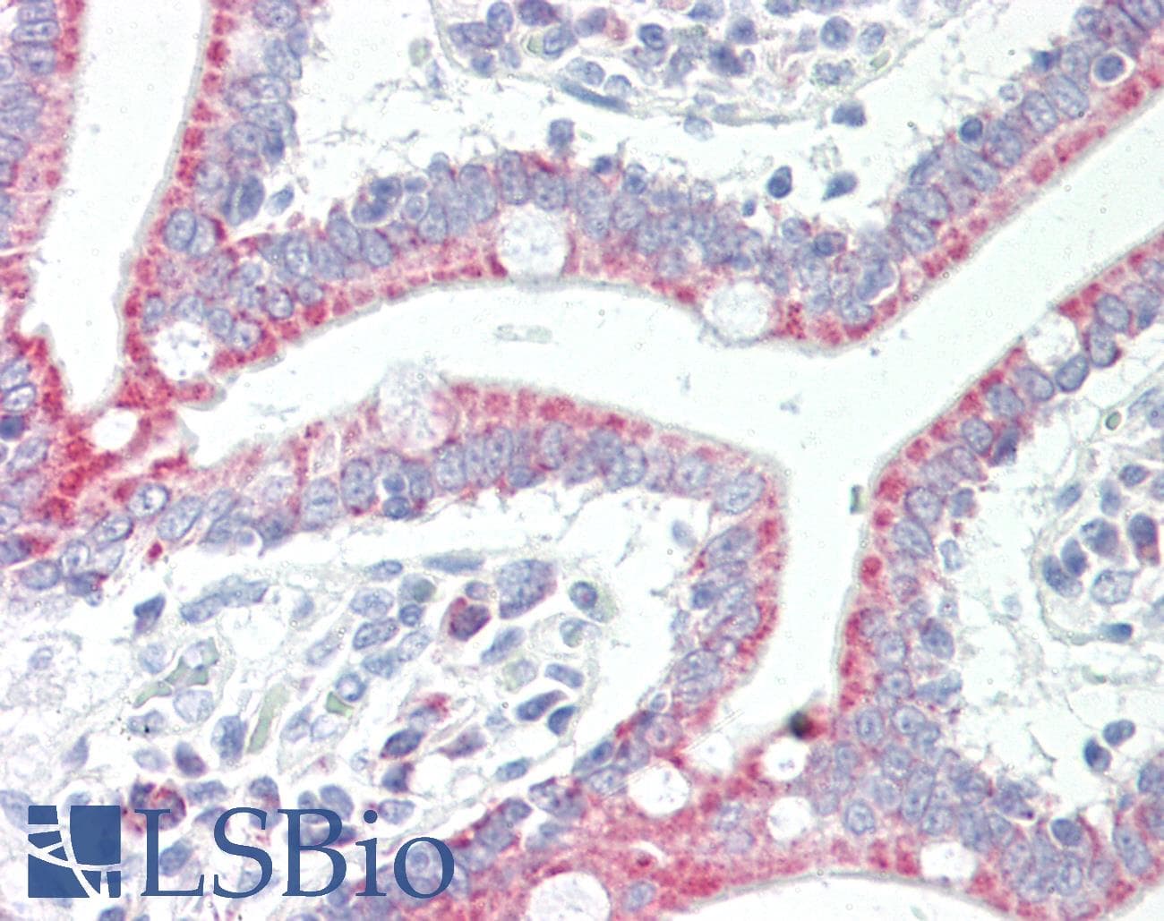 SLC33A1 Antibody (aa216-265)