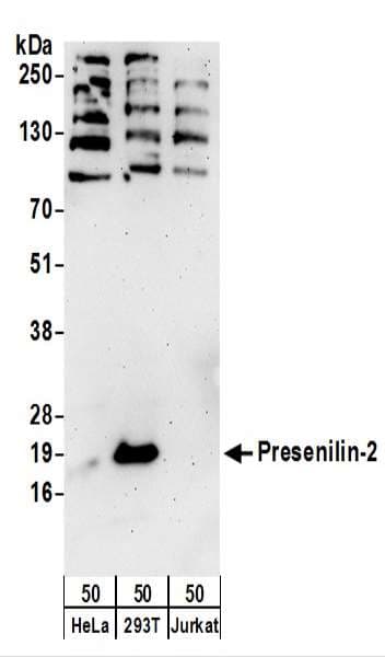 IHC-plus™ Polyclonal Rabbit anti-Human PSEN2 / Presenilin 2 Antibody (aa275-325, IHC, WB)