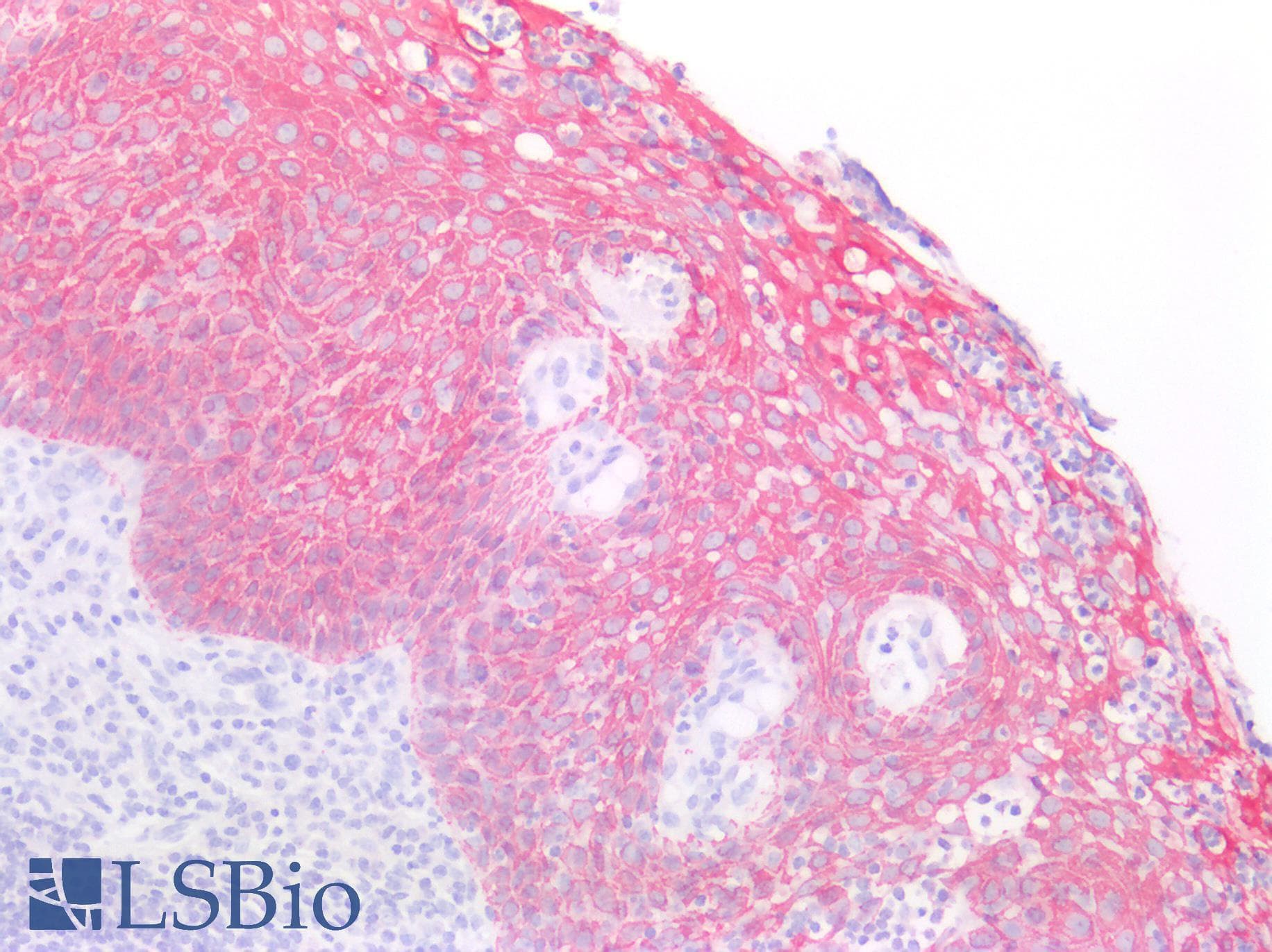 IHC-plus™ Monoclonal Mouse anti-Human KRT5 / CK5 / Cytokeratin 5 Antibody (clone OTI1C7, IHC, WB)