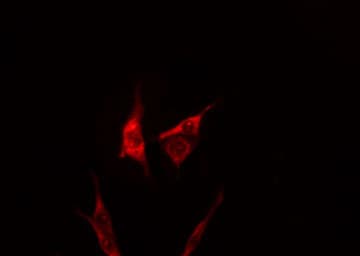 MYH14 Antibody
