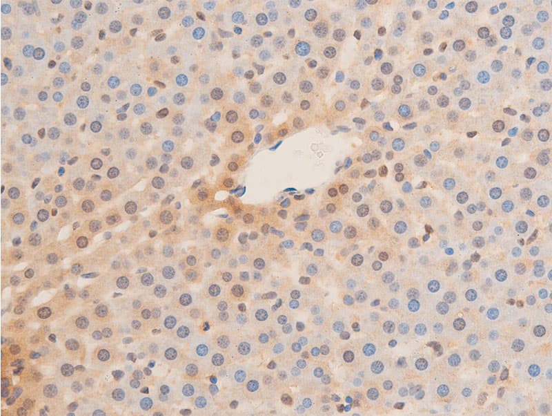 LMNA / Lamin A+C Antibody (phospho-Ser392)
