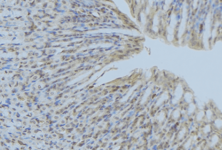 ACP5 / TRAP Antibody