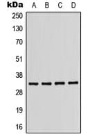 KIR2DL2 / CD158b Antibody (Internal)