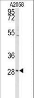 Polyclonal Rabbit anti-Human PRKCDBP / CAVIN3 Antibody (aa113-144, WB)