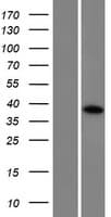CCDC160 Protein (Over-Expression Lysate Myc-DDK (Flag))