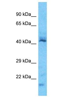 PXN / Paxillin Antibody (aa49-98)