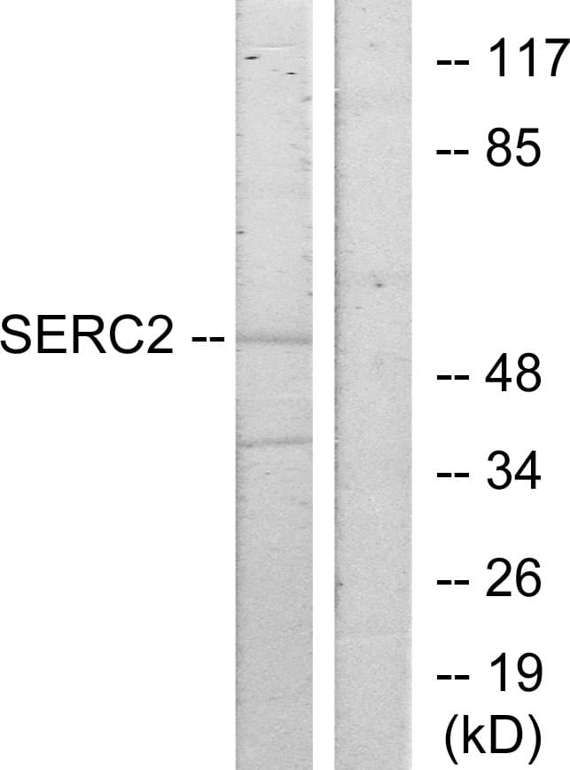 IHC-plus™ Polyclonal Rabbit anti-Human SERINC2 Antibody (aa341-390, IHC, IF, WB)