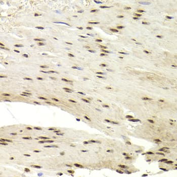 Polyclonal Rabbit anti-Human PRC1 Antibody (IHC, WB)