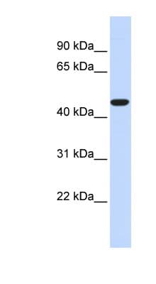 Polyclonal Rabbit anti-Human ACOT2 Antibody (aa360-409, WB)