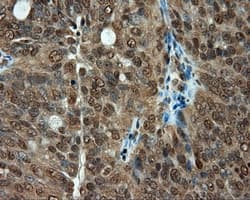 Monoclonal Mouse anti-Human PSMC3 Antibody (clone OTI1C10, IHC, IF, WB)