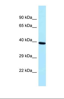 PRPF18 Antibody (aa120-169)