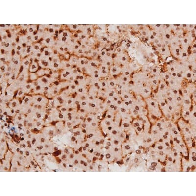 STAT3 Antibody (phospho-Tyr705)