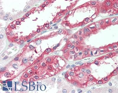 IHC-plus™ Polyclonal Rabbit anti-Human KCND3 / Kv4.3 Antibody (aa13-41, IHC, WB)