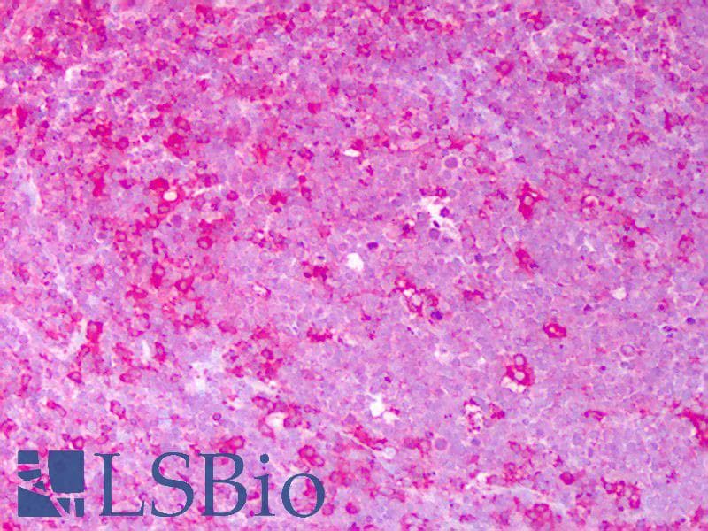 IHC-plus™ PDI Antibody