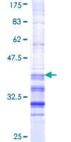 Human TCF21 / Epicardin Protein (Recombinant GST, N-terminus)
