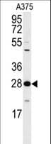 YWHAZ / 14-3-3 Zeta Antibody (Thr232)