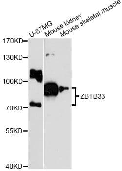 ZBTB33 / Kaiso Antibody