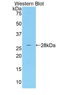 MASP2 / MASP-2 Antibody (aa445-683, FITC)
