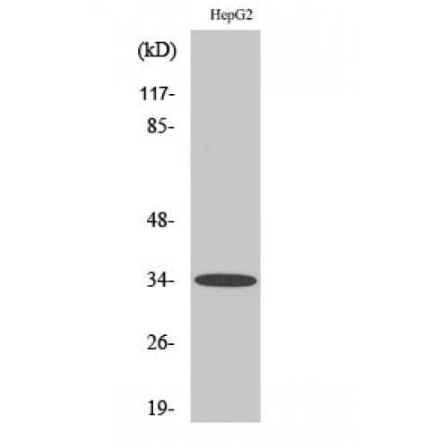 Polyclonal Rabbit anti-Human ACKR2 / CCR10 / D6 Antibody (310-390 aa, C-terminal, IHC, IF, WB)
