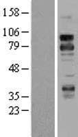 TNFRSF21 / DR6 Protein (Over-Expression Lysate Myc-DDK (Flag))