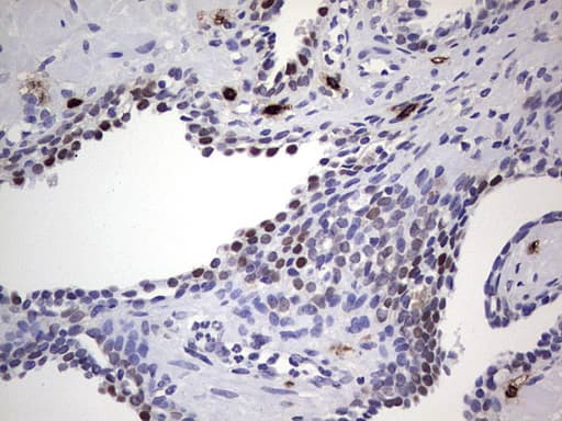 NKX3-1 Antibody (clone OTI2D11, Carrier-free)