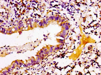 ARID3A / DRIL1 Antibody