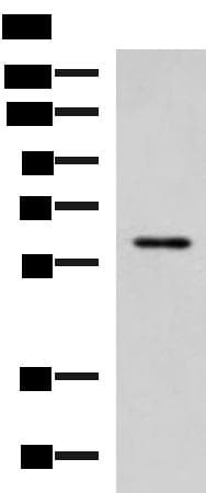 ECM1 Antibody
