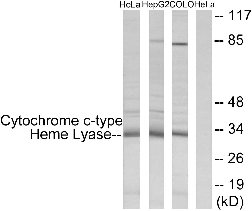 IHC-plus™ Polyclonal Rabbit anti-Human HCCS Antibody (aa81-130, IHC, IF, WB)