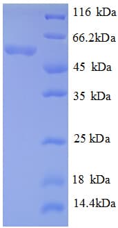 E. coli gadA / Glutamate Decarboxylase Protein (Recombinant His)