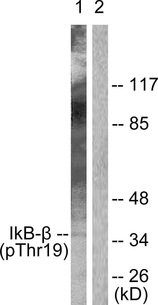 NFKBIB / IKB Beta / IKBB Antibody (phospho-Thr19)