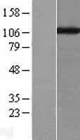 CHAF1A / CAF1 Protein (Over-Expression Lysate Myc-DDK (Flag))