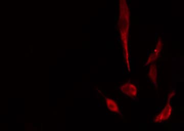 Polyclonal Rabbit anti-Human CBR3 Antibody (IHC, IF, WB)